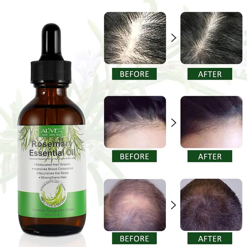 زيت أكليل الجبل لنمو الشعر - Growth Hair Rosemary Essential Oil